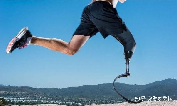 假肢與矯形器制造行業(yè)的未來發(fā)展趨勢(shì)